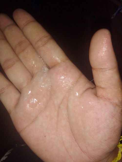 มูกใสๆแบบนี้ เยอะมากอันตรายไหมค่ะ36+5