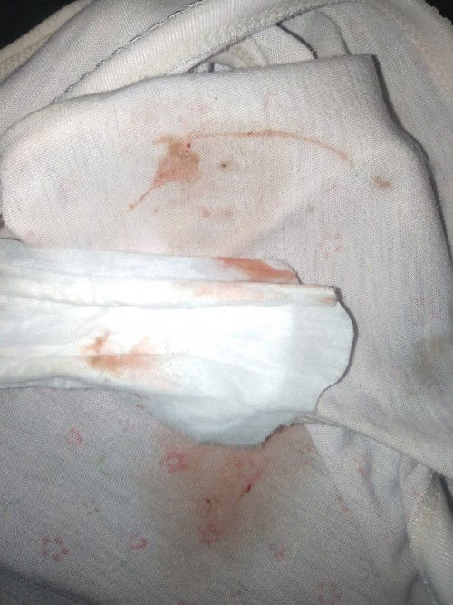 Lendir + darah tanda persalinan sudh dekat???