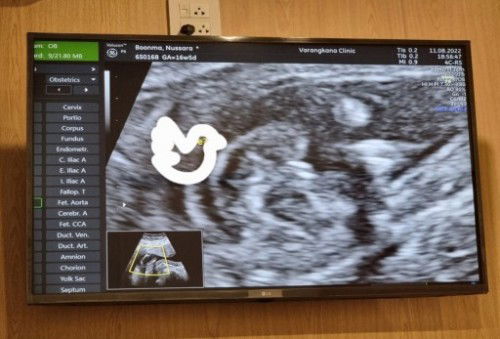 ชายหรือหญิงค่ะ