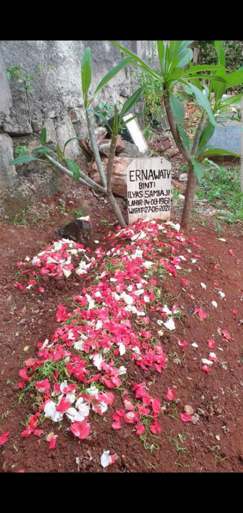 pengalaman kuret BPJS, janin tdk berkembang tdk ada flek/ keram. Di induksi 8jam