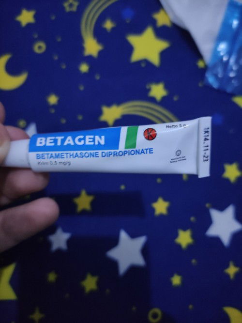 Bayi 2week bruntusan dan biang keringat