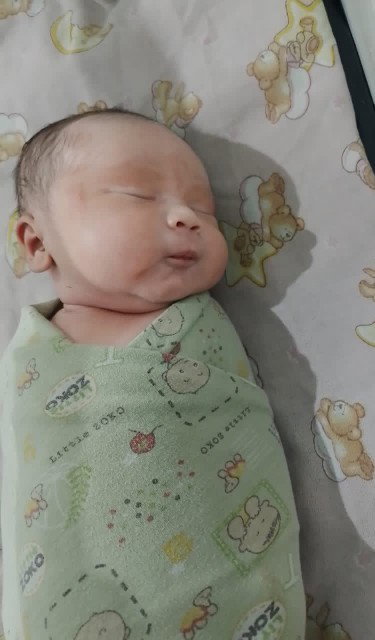 Pasca melahirkan operasi