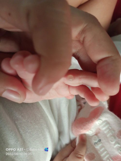 Ano po kaya itong nasa daliri ni baby ?