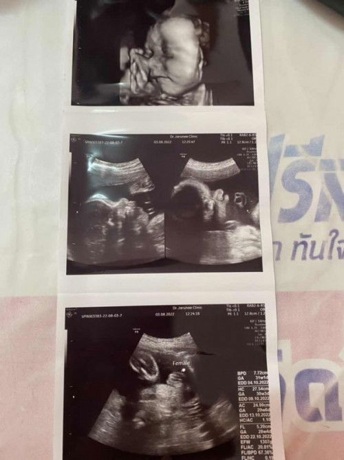 #วันแม่2565🤍🤍