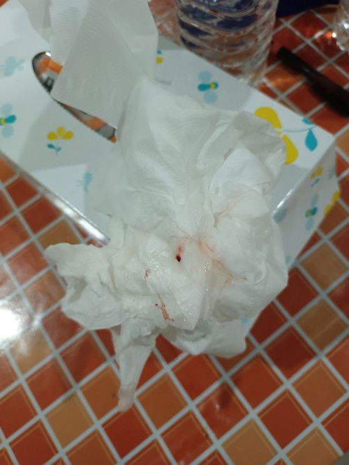 สอบถามประสบการณ์จากแม่ๆ