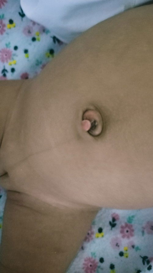 Magtatanong po about sa PUSOD ni Baby