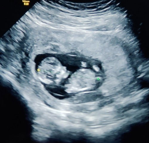 สวัสดีวันแม่