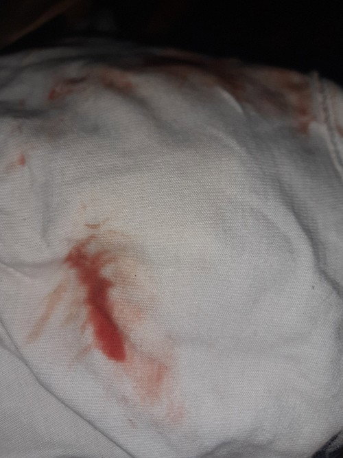 Una brown watery discharge mgayon ganyan spotting ko may cramps din sa bandang puson. 3 months preg