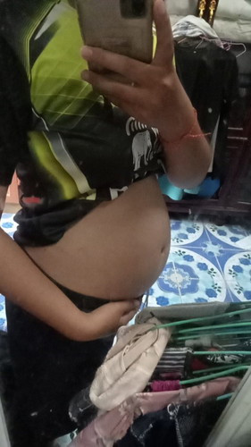 แอบอิจฉาคนได้ลูกชายแล้วไม่มีสิว บ้านนี้สิวขึ้นหลังและหน้าท้องบ้านไหนขึ้นเหมือนกันไหมคะ🤣☺️
