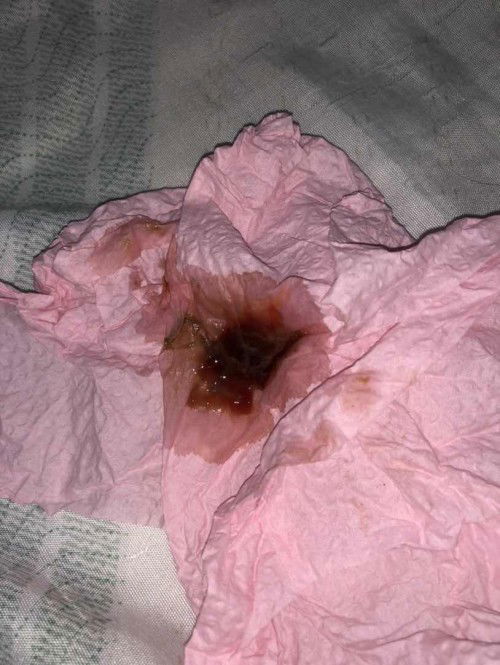 Masih keluar darah & lendir darah lepas kena seluk