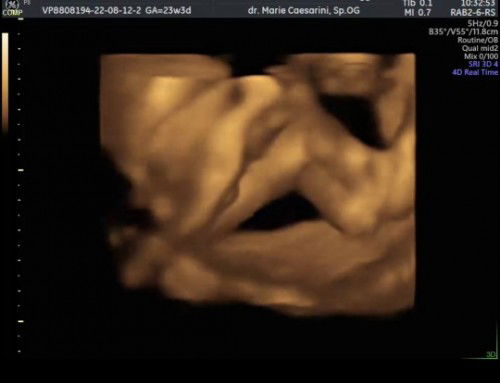 USG Cek jenis kelamin di 23 Weeks