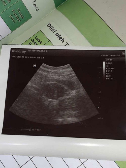 Tespek positif, tapi usg belum terlihat