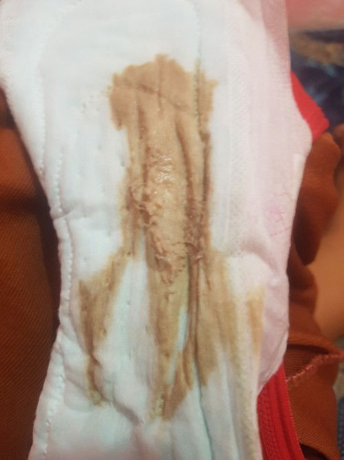 Shering donk mamah2...maaf bukan nya ga sopan atau jorok iya,saya cuman mau tanya tanda nya apa ?