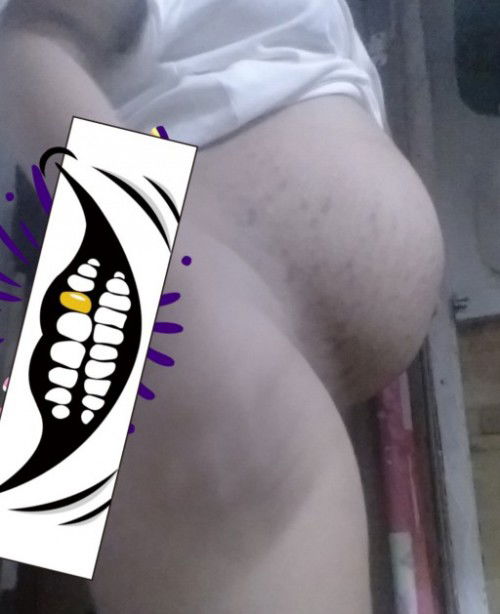 Mababa napo ba tyan ko ?