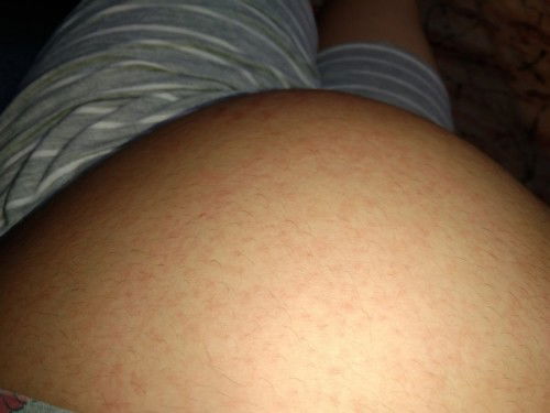 I'm 27wks preggy Po.