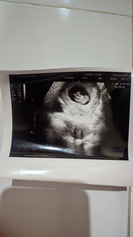 bingung dengan hasil usg