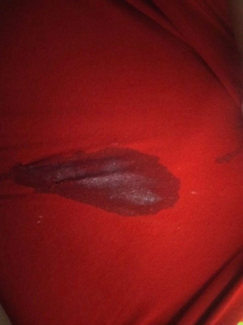 Kehamilan 38 Minggu keluar air bercampur bercak putih??