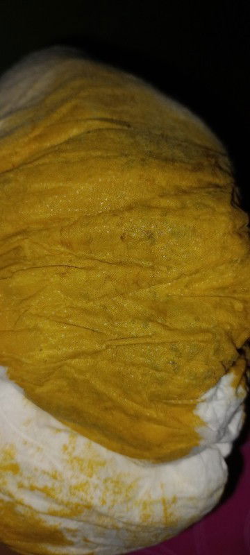 BAB cair tidak berampas, usia 2 bulan (mohon dskip fotonya klau tidak berkenan🙏)