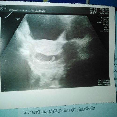 สอบถามแม่ๆคะ