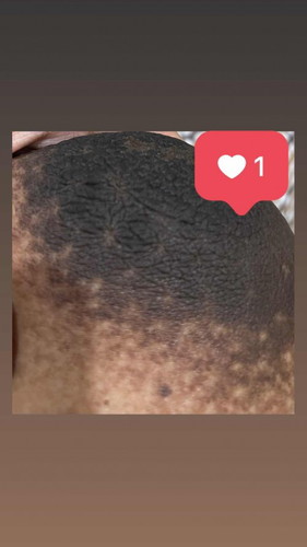 Concerned Boob/areola