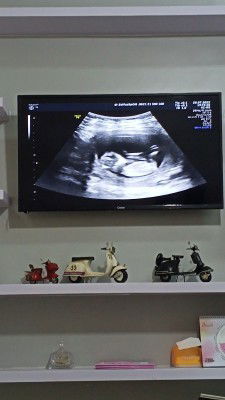 Masya Allah tabarokallah