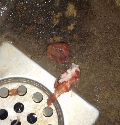 Possible miscarriage