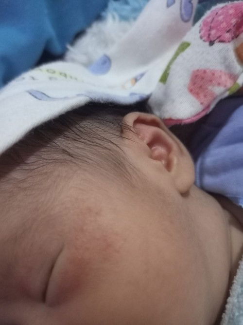 kulit mata babynewborn