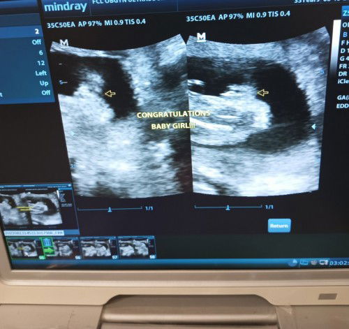 Congenital anomaly Scan