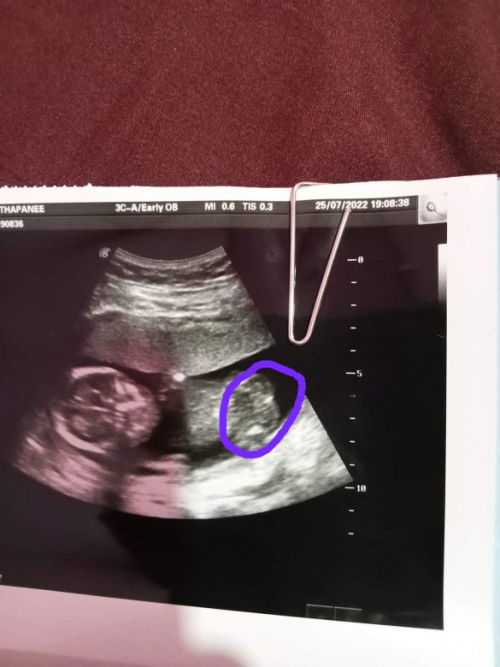 แม่ๆช่วยดูหน่อยค่ะ