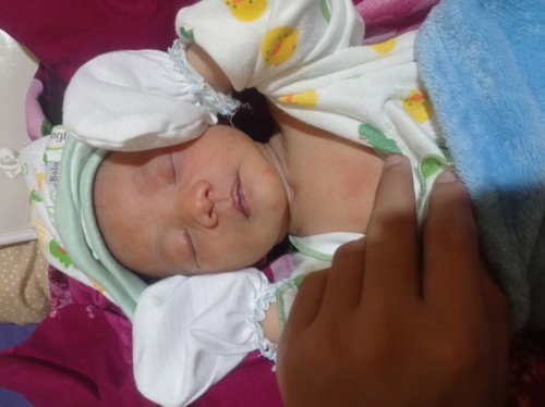 Muka bayi kaya merah merah