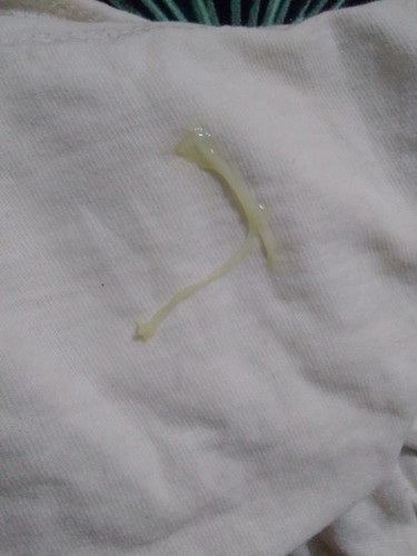 Mucus plug napo ba ito?36&3days