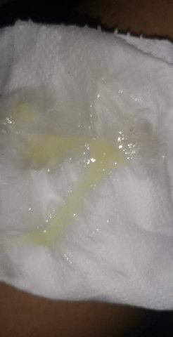 Mucos plug sign na malapit na akung manganak sa Tuesday due ko na base sa lmp