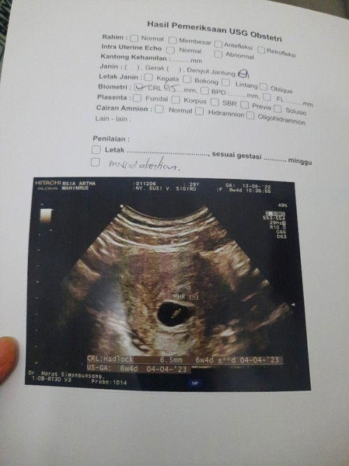 Janin tidak berkembang