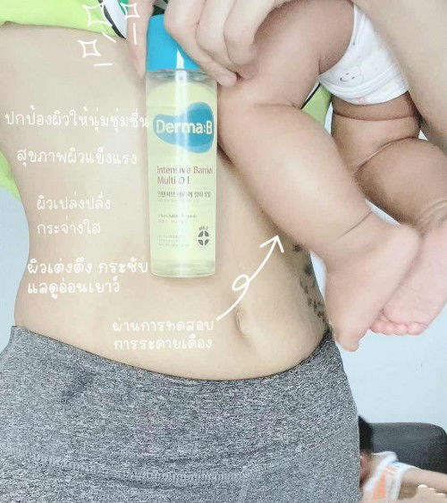 #คุณแม่นักรีวิว ปัญหาผิวของคุณแม่ แนะนำน้ำมันออยบำรุงผิวแม่ท้องแม่ลูกอ่อน