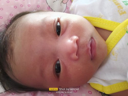 Bintik putih pada bayi