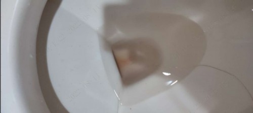 PAG IHI NG DUGO HABANG BUNTIS