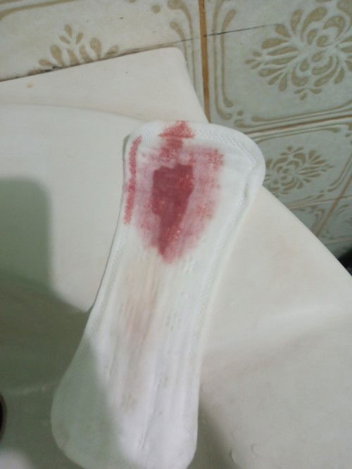 Bleeding after IE