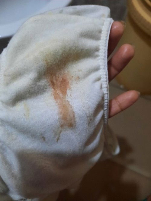 DELIKADO PO BA YUNG GANTONG SPOTTING?