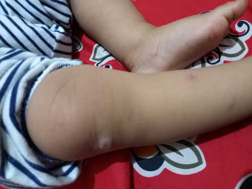 Ada yang tau nggak atau pernah ngalami anak nya bunda begini..