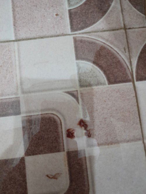 Hamil 8w keluar flek.