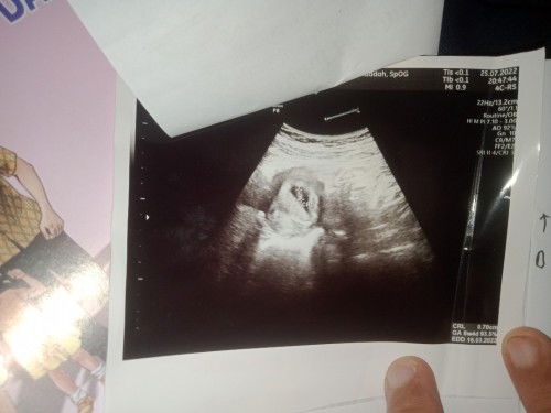 Maaf bertanya hamil anak pertama