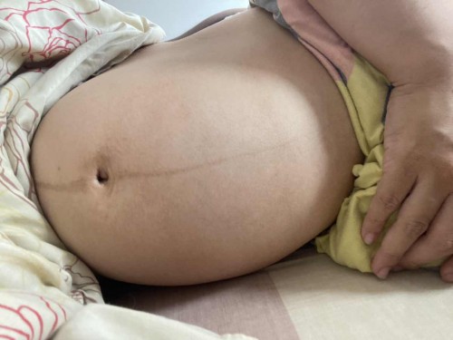 ดิ้นทีท้องแทบทะลุแล้วจ้า ช่วยด้วย !!