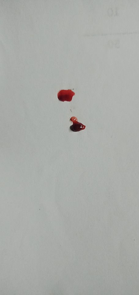 Good morning po sayo mam,pwede po bang mag tanong.?
Yung Last Menstration ko ay July 17 to