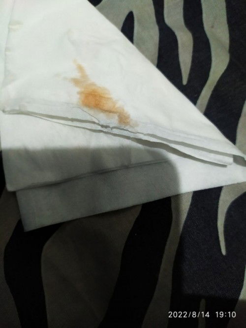 Keluar flek darah merah