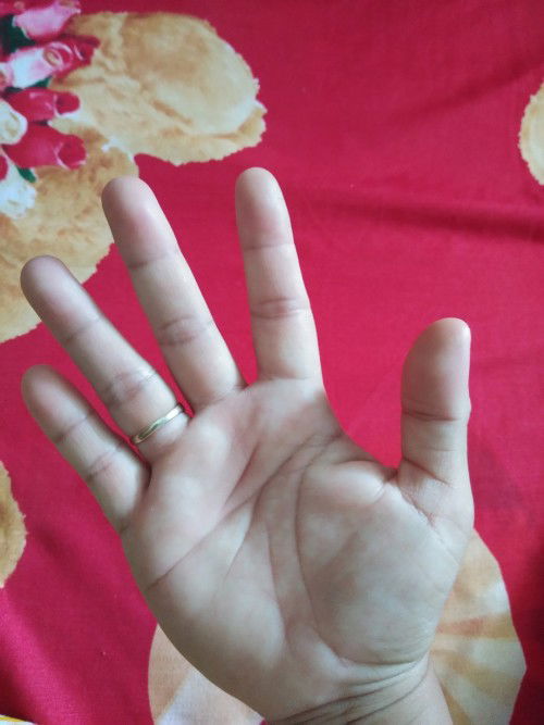 Tangan Kanan Kesemutan