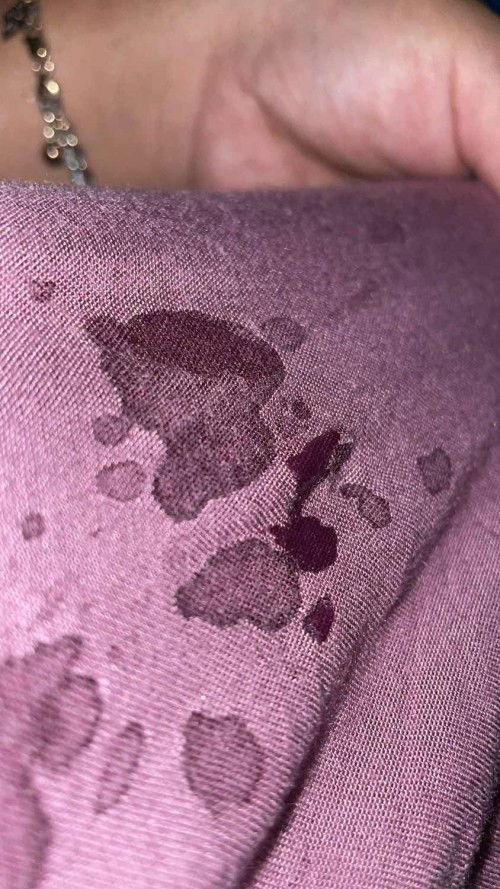 Keluar kolostrum/ASI dimasa kehamilan