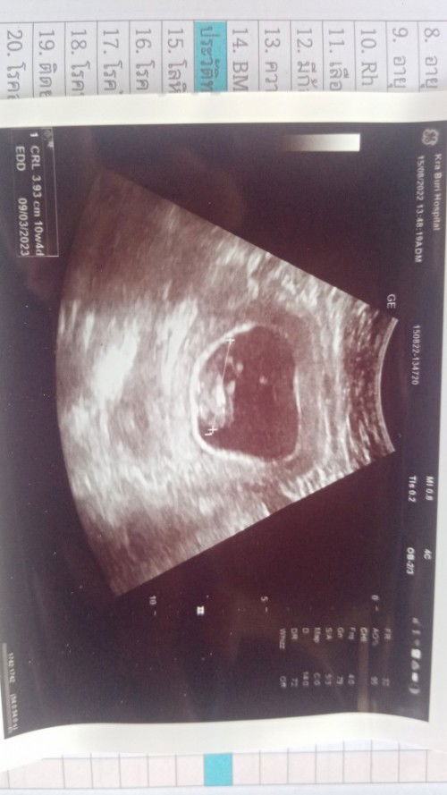 ขนาดของน้องปกติมั้ยค่ะ