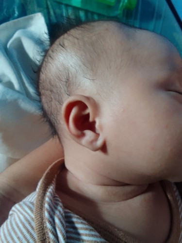HEAD SHAPE NI BABY