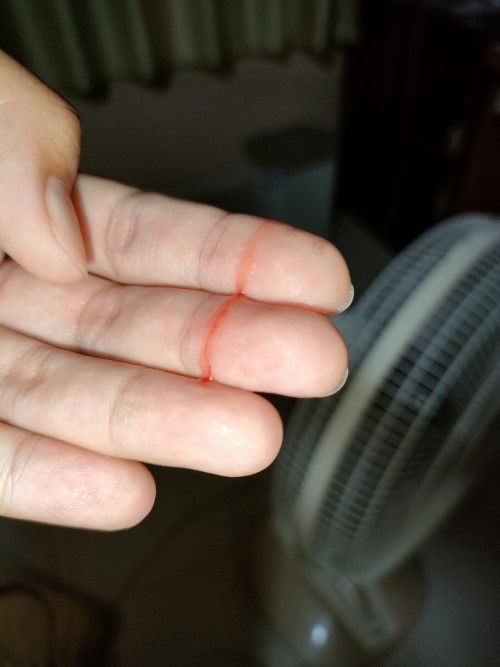 มีมูกออกแบบนี้ ไม่มีอาการใดๆ จะเป็นไรไม่คับ