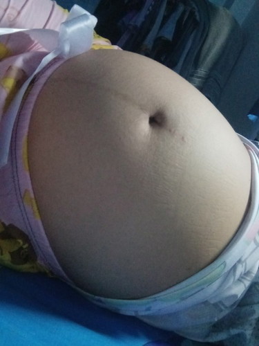 ลูกไม่ดิ้น